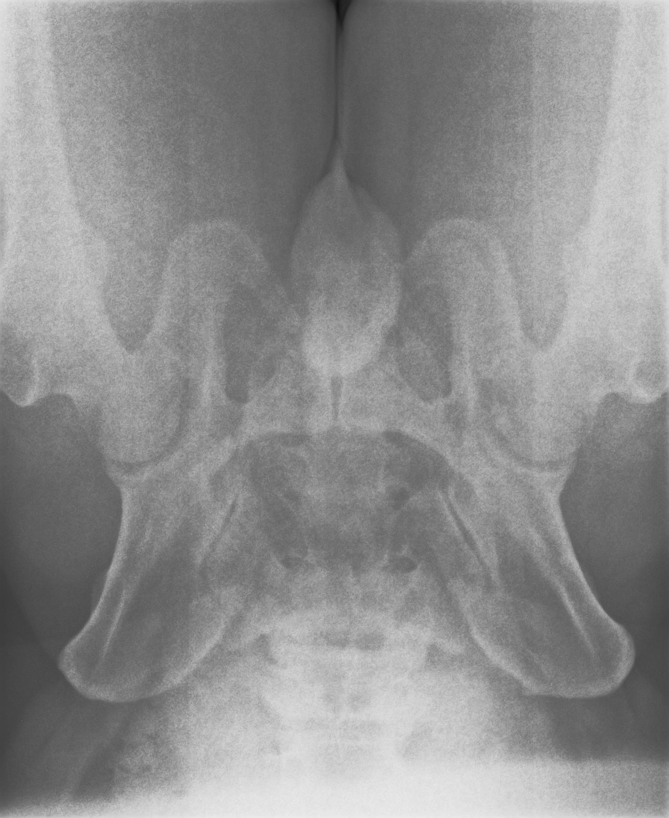 Pelvis yakın plan röntgen görüntüsü